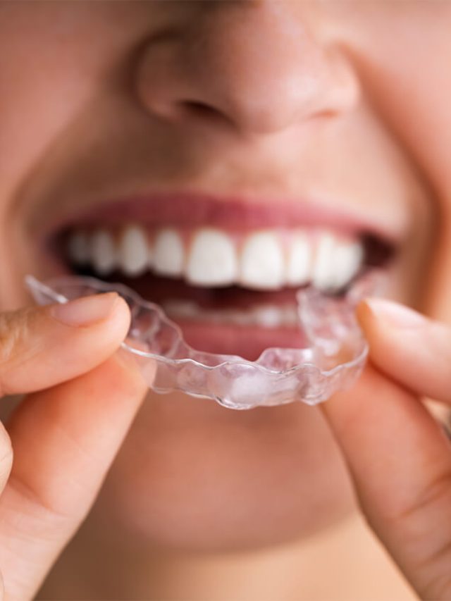 Invisalign, the clear choice for a straighter smile